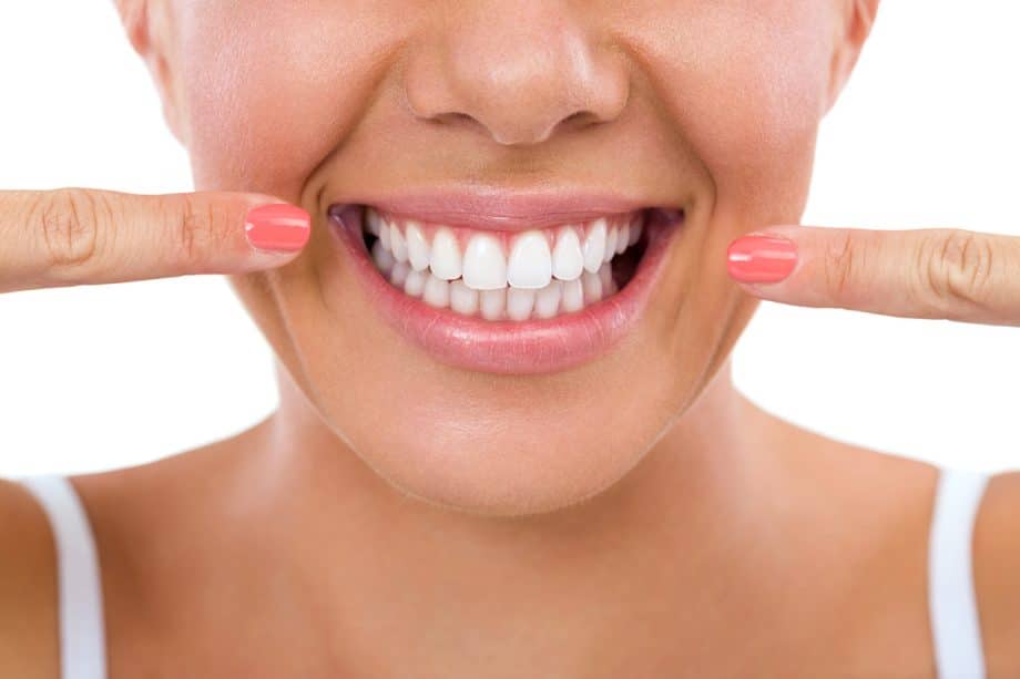 3 Options for Whitening Your Teeth