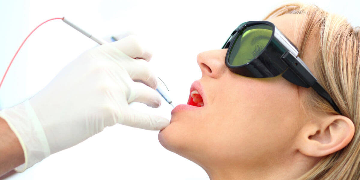 Veneers, Glen Cove, NY