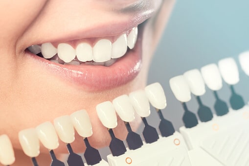 color whitening matching strip against woman's actual teeth