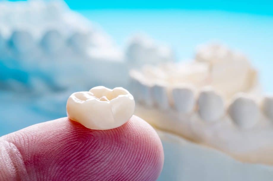 Can a CEREC Crown Be Used on a Front Tooth?