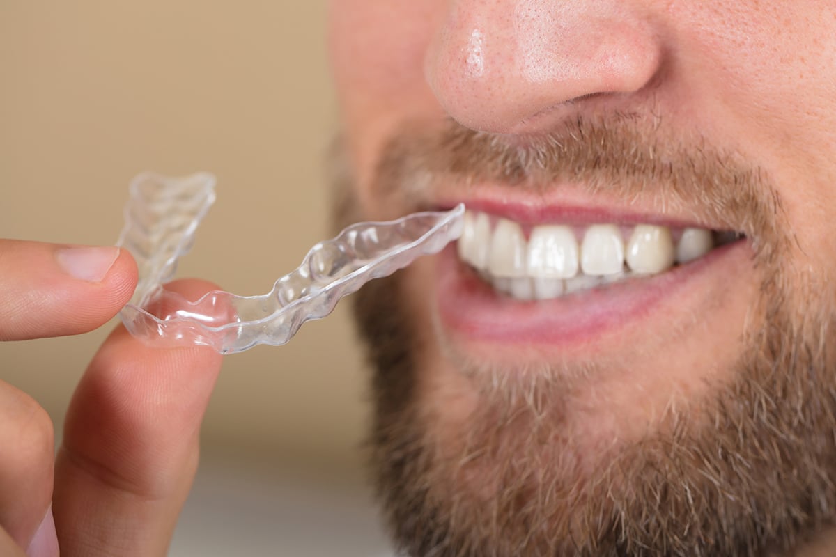 Can You Eat With Invisalign? Gold Coast Smiles
