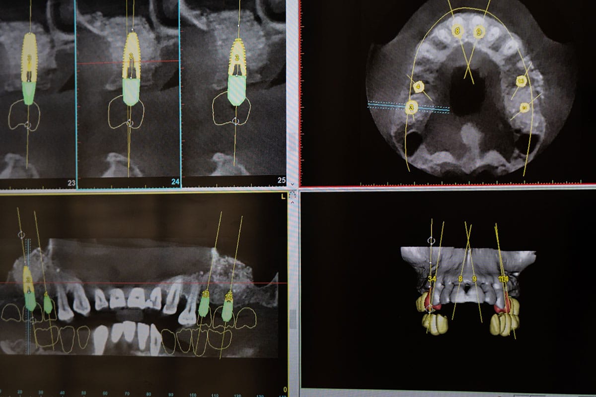 Cone Beam Scanner