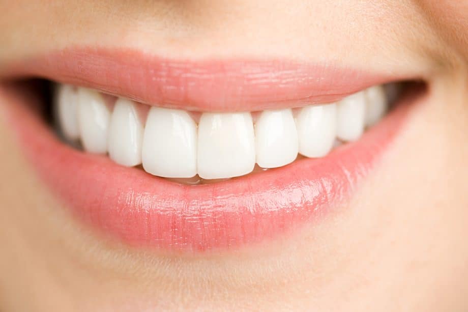 How Long Does It Take To Whiten Teeth?